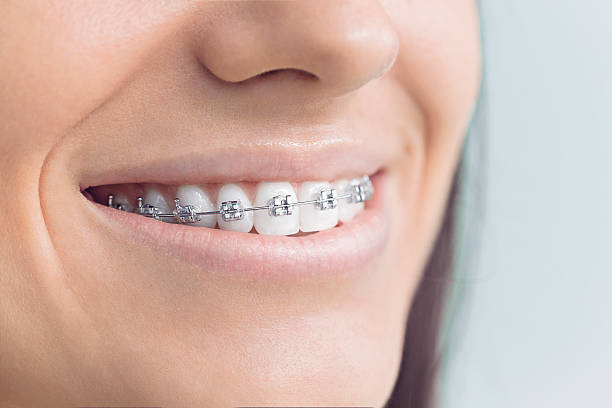 Best Traditional Braces  in Duncan, OK